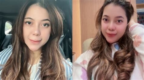 Siapa Dokter Kamelia? Akhirnya Klarifikasi Soal Hubungan dengan Ammar Zoni