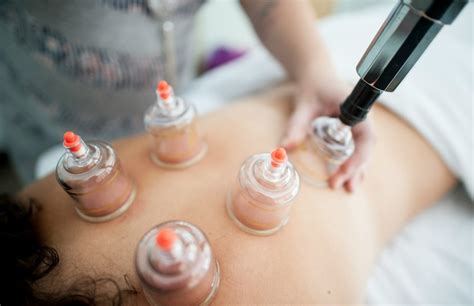 cupping therapy helps muscle recovery complete guide