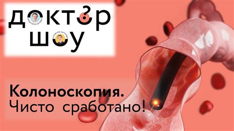 Доктор-шоу Колоноскопия: чисто сработано! Выпуск 1 - YouTube