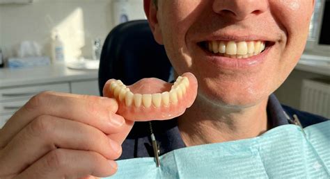 Can You Eat With Flipper Teeth? Guide to Eating Tips, Foods to Avoid