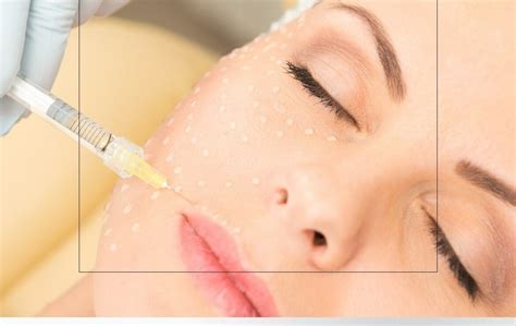 BIOREVITALIZĀCIJA – Lāzerklinika