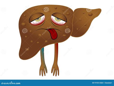 Chronic Liver Disease Cartoon