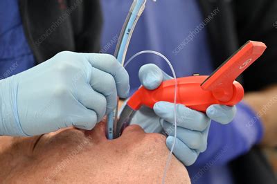 patient  intubated stock image  science photo library