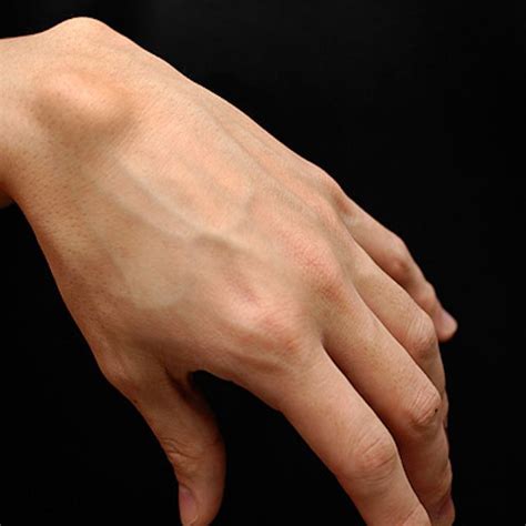 Wrist Ganglion Cyst Lump On The Back Of The Hand | Images and Photos finder
