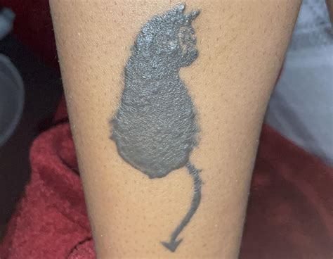 7+ month healed tattoo is slightly raised and has all these bumps on it