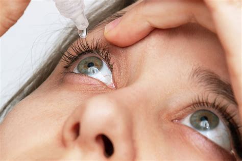 IPL for Dry Eye Auckland | Meibomian Gland Dysfunction Treatment NZ
