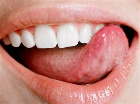 How to Get Rid of a Pimple on the Tongue - Flash Uganda Media