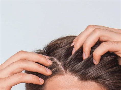 scabs  sores  scalp pictures  treatment
