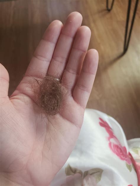 is it normal parrot losing hair naturally 3