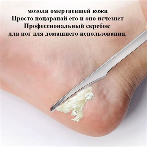 Нож Для Педикюра, Бытовые Инструменты Для Удаления Омертвевшей Кожи И ...