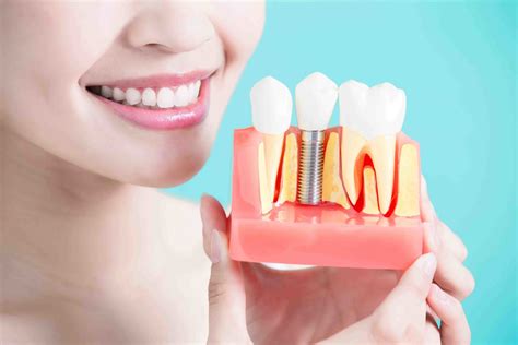 insurance for dental implants 6