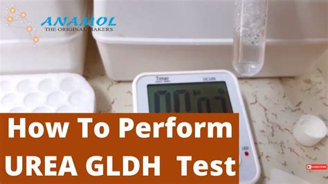 Urea Test Procedure | Urea UV Test - YouTube