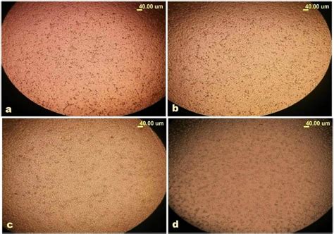 Representative photos of Caco-2 showing the morphological changes and ...