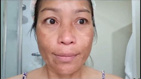 Zoo-Son Whitening Freckle Cream Review | Miracle Cream 😍 | Zoo-Son ...