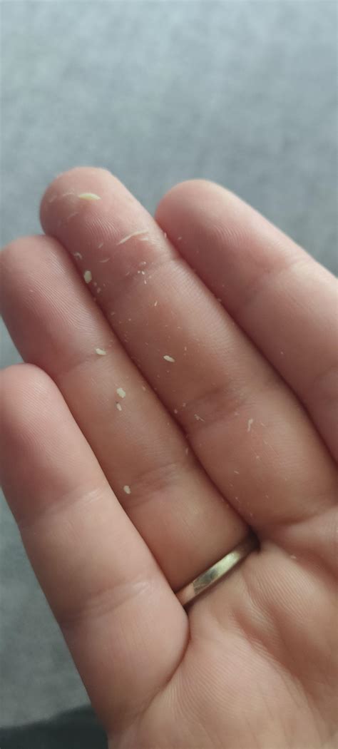 Weird dry vaginal discharge? : r/medical_advice