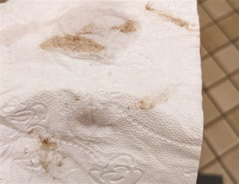 Light Brown Spotting Pregnant Dark Brown Discharge After Ovulation