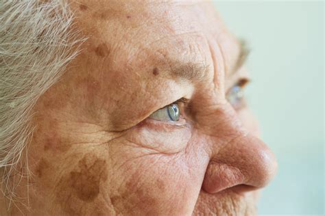 Everything you need to know about Alzheimer's disease