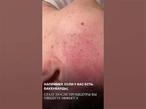 Щетина на женском лице⛔️ - YouTube