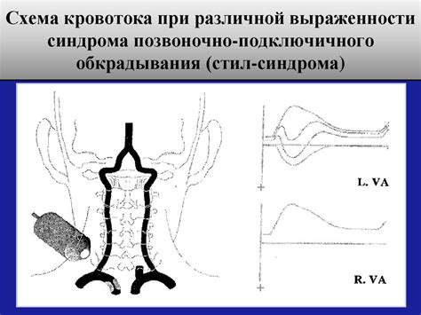 Позвоночные артерии - презентация онлайн