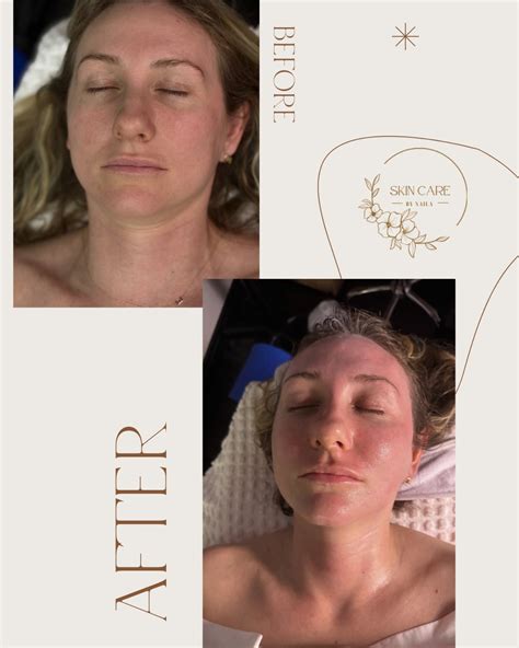 Skincare - Transformational Glow! Check out this amazing before and
