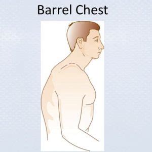 barrel-chest - Me and My Waist