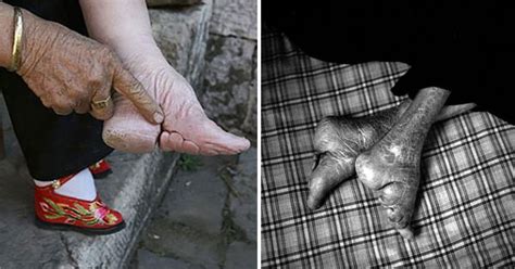 These Are The “Lotus Feet” Of The Last Women In China Who Practise Foot ...