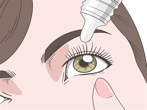 How to Treat Crossed Eyes: 11 Steps (with Pictures) - wikiHow