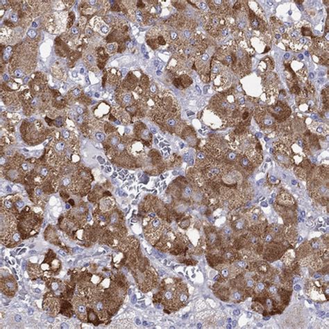 Chromogranin C Antibody (PA5-82438)