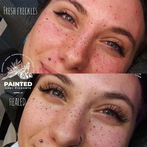Semi-Permanent Freckle Tattoos: The Ultimate Guide