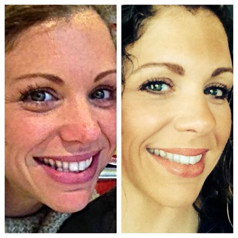My wife before and after one year later using Nerium!!! | Nerium, Wife