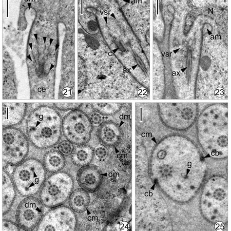 Centriole functions. (A) Centrioles are required for the formation of ...