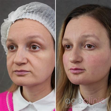 Клиника эстетической медицины и косметологии в Москве | Age Clinic