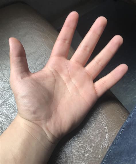 People say that I have fat hands, is this really true? : r/teenagers