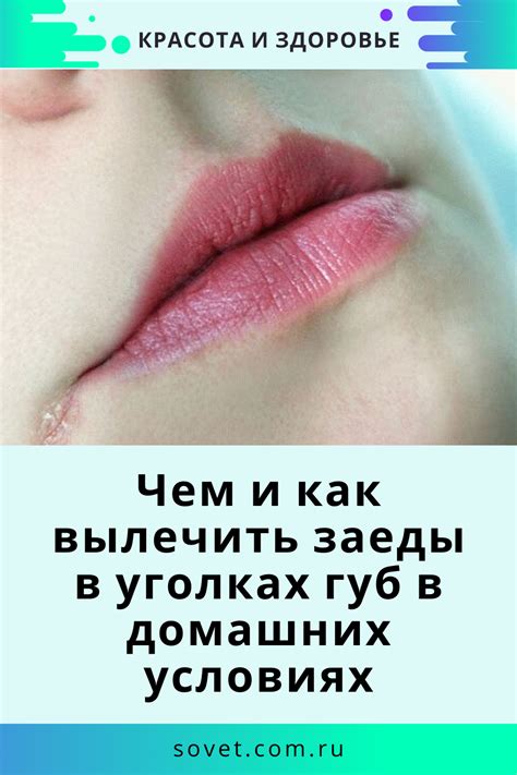 Разное | Постила | Домашнее лечение, Лицо, Губы