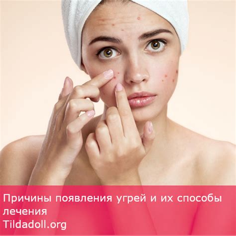 Почему появляются прыщи? Почему нельзя давить прыщи