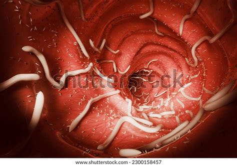 Roundworms In Humans