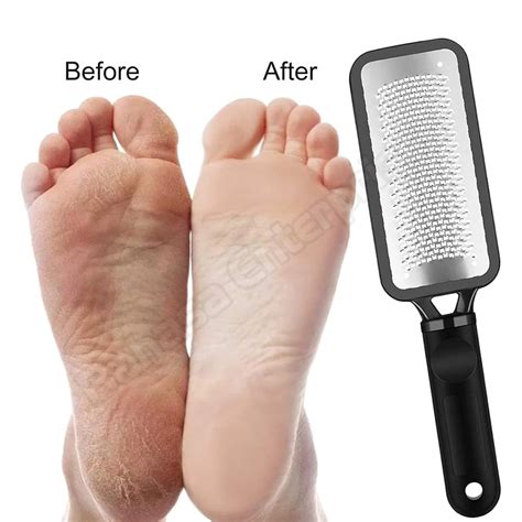 Waterproof Foot Callus Remover Foot File Pedicure 2 Pcs Tool Kit ...