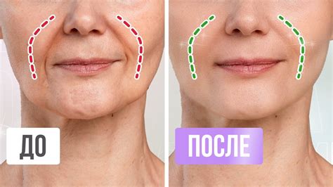 Убираем НОСОГУБНЫЕ СКЛАДКИ за 10 МИНУТ | Простые упражнения от ...