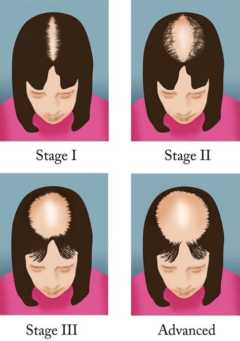 Biotin Vitamininin Faydaları Nelerdir?