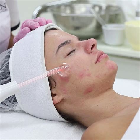 High Frequency Treatment in Surrey