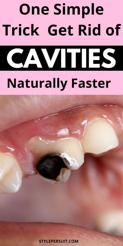 how to get rid of cavity at home
