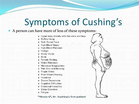 Cushing’s powerpoint 