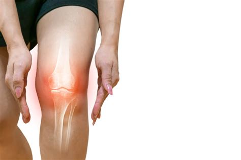 Arthrose - Rosen-Apotheke, Wiesbaden