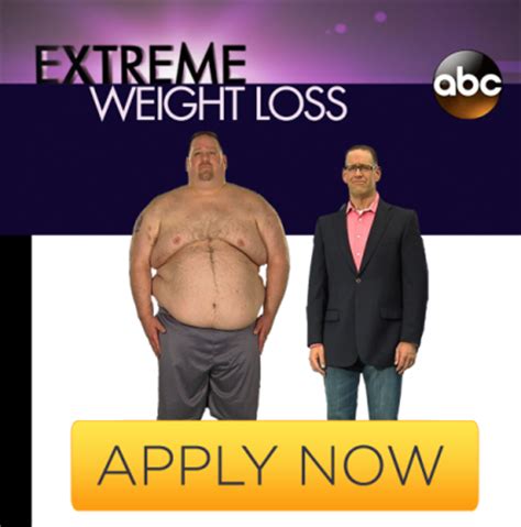 Abc Extreme Weight Loss Season 5 - ES