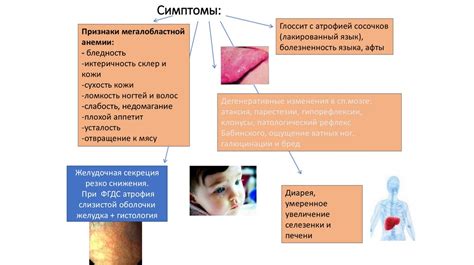 Пернициозная анемия или B12-дефицитная анемия - online presentation