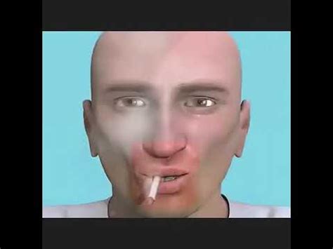 Вред курения , как курение влияет на зубы - YouTube
