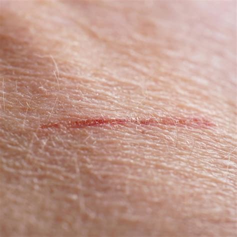 Premium Photo | Skin cut macro
