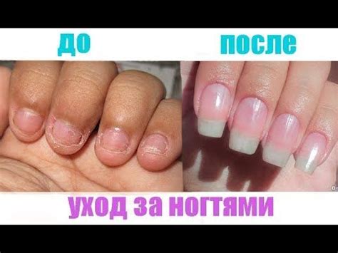 Как ОТРАСТИТЬ ногти за 3 ДНЯ | УХОД за ногтями // УКРЕПЛЕНИЕ ногтей # ...