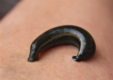 Do Parasite Has Anything To Do With Environment?
