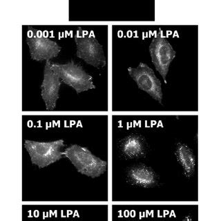 LPA induces the time-dependent internalization of LPA1 in HeLa cells ...